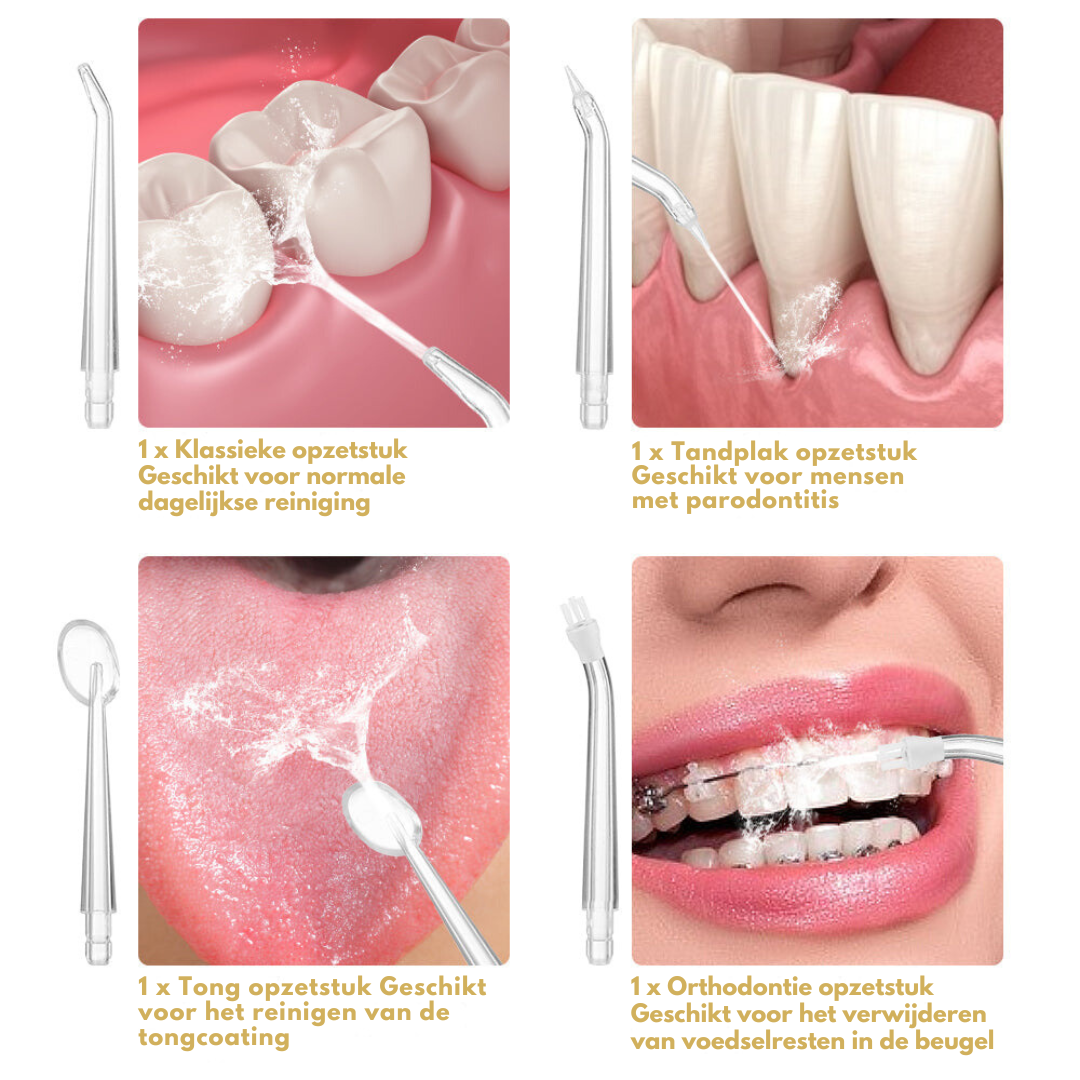 SmileFresh Waterflosser