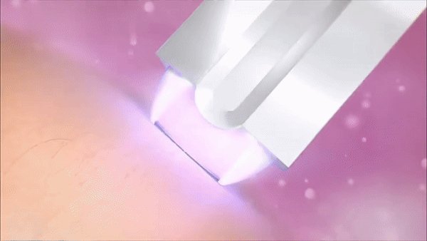 FlawlessGlo Epilator