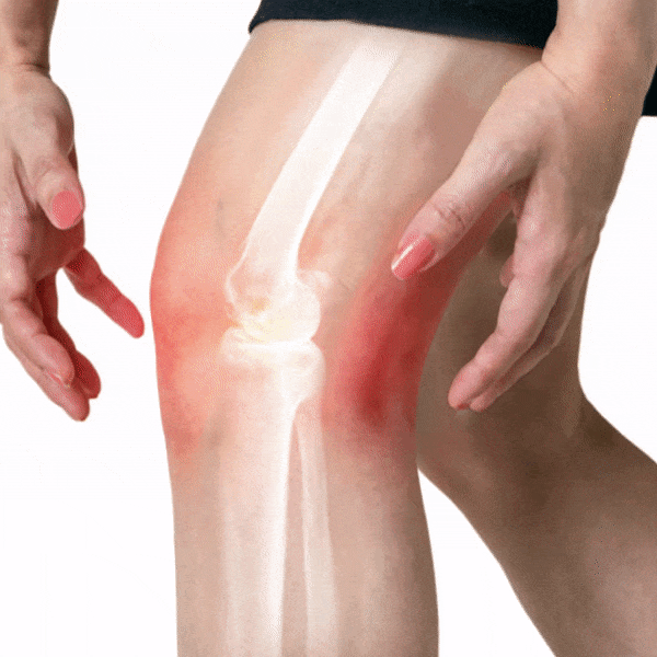 PowerPainRelief Knie Therapie