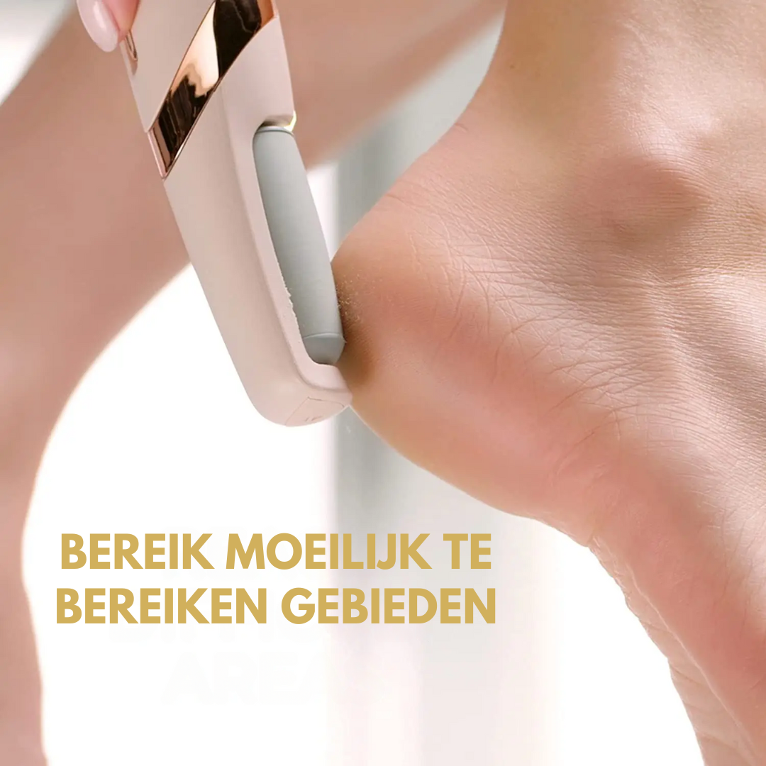 SoleCare Eeltverwijderaar