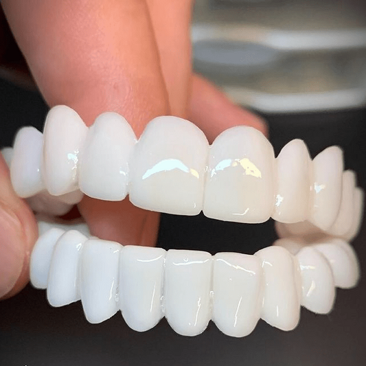 SmileFlex – Tandprothese met witte tandheelkundige facings