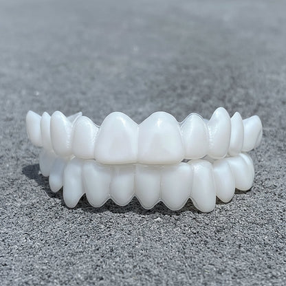 SmileFlex – Tandprothese met witte tandheelkundige facings