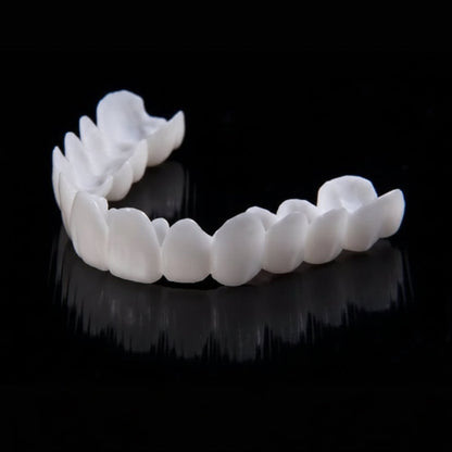 SmileFlex – Tandprothese met witte tandheelkundige facings