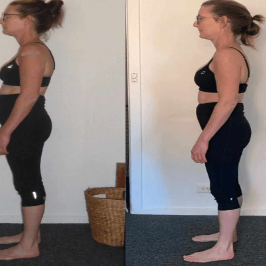SpineAlign Houdingcorrector
